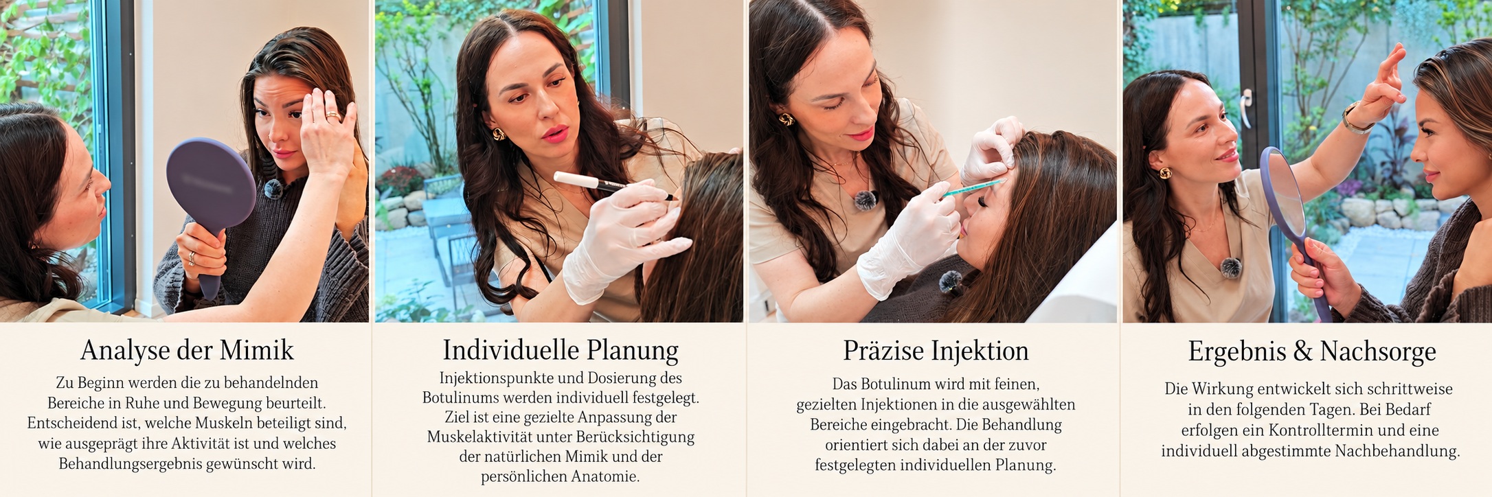 Ablauf einer Behandlung mit Botulinumtoxin bei LIMEA in vier Schritten: Analyse der Mimik, individuelle Planung, präzise Injektion, Ergebnis und Nachsorge