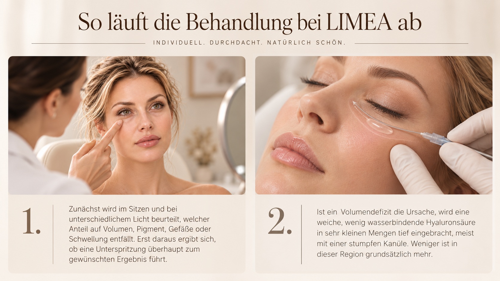 Tränenrinne unterspritzen bei LIMEA: Beurteilung der Augenpartie und Behandlung mit stumpfer Kanüle
